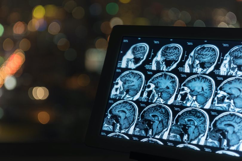 You are currently viewing Check out our newly listed #DoctorJob for a Consultant Neuro Radiologist on the …