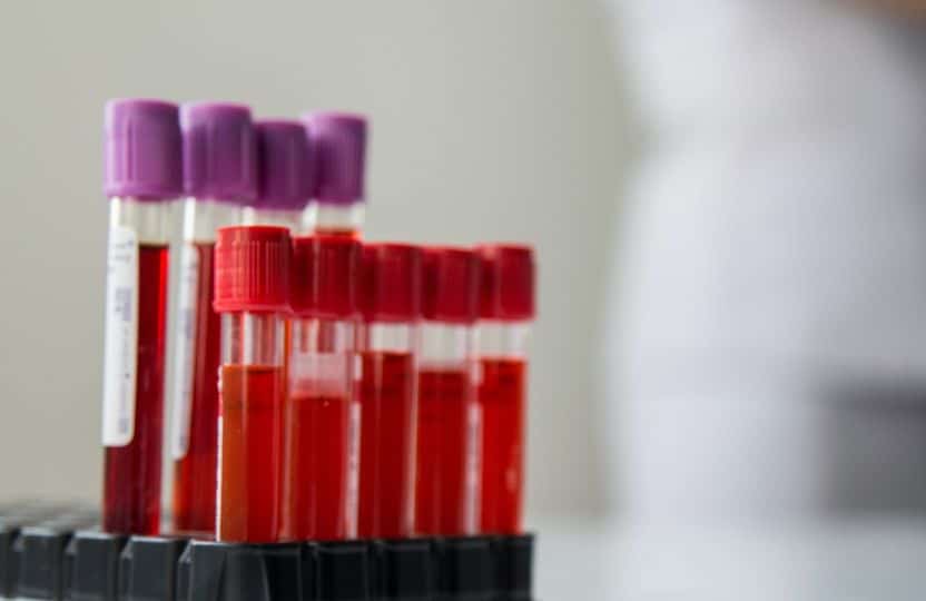 You are currently viewing We’re recruiting for a new Consultant #Haematologist Doctor position based in #N…