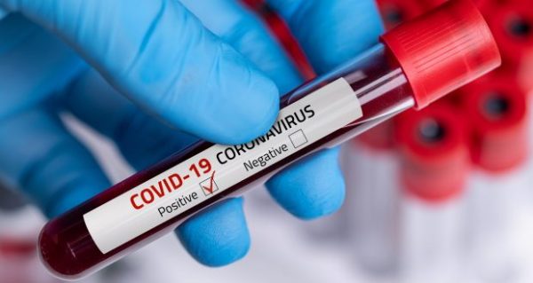 coronavirus test 620x330 1